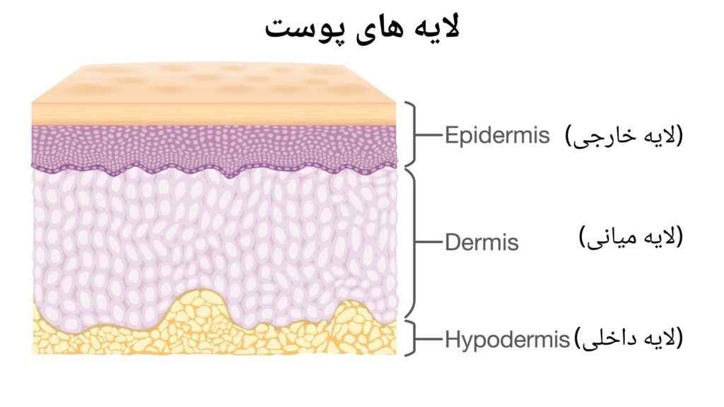تصویری از لایه های پوست که در اول لایه خارجی بعد میانی و در آخر لایه داخلی میباشد